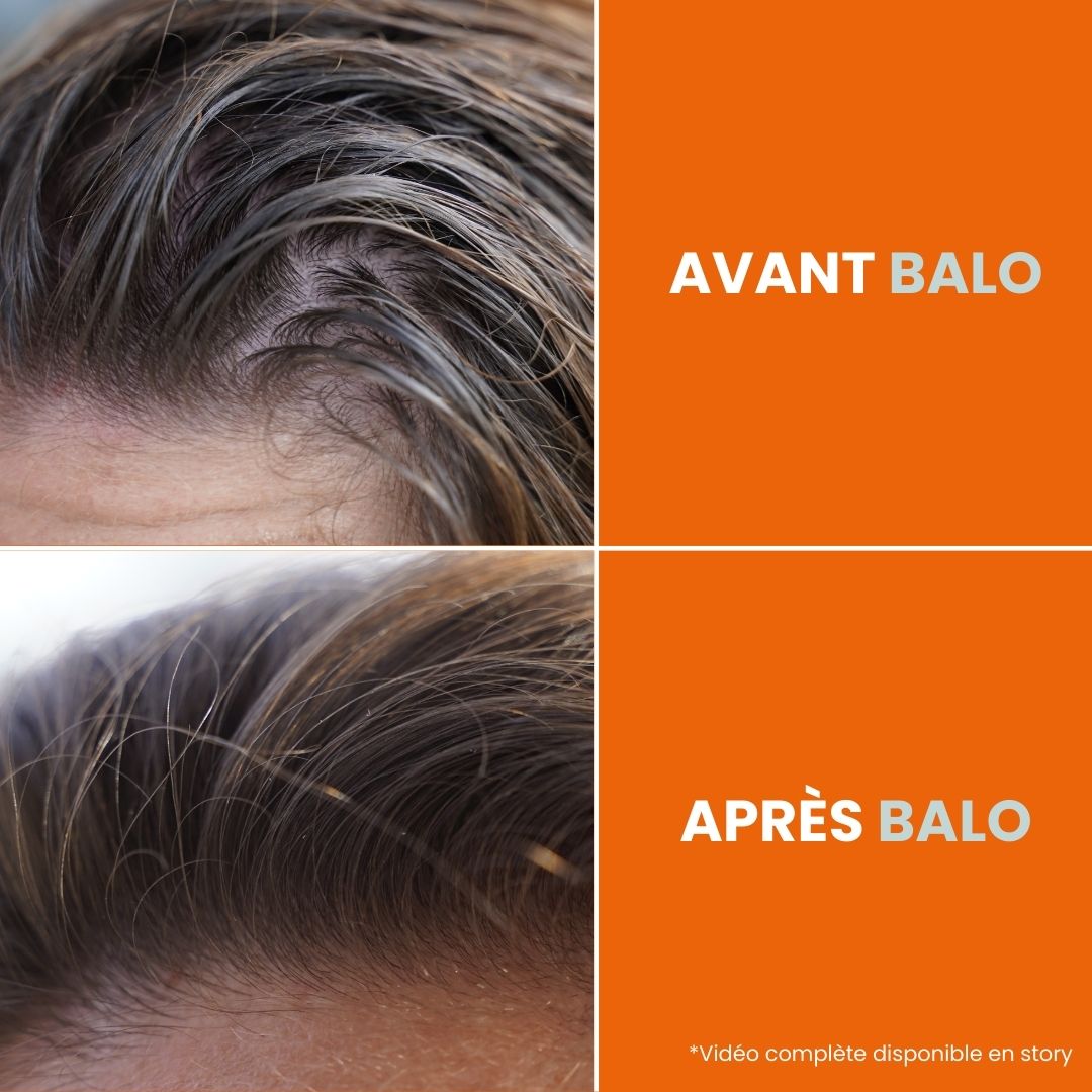 Mini shampoing sans lavage